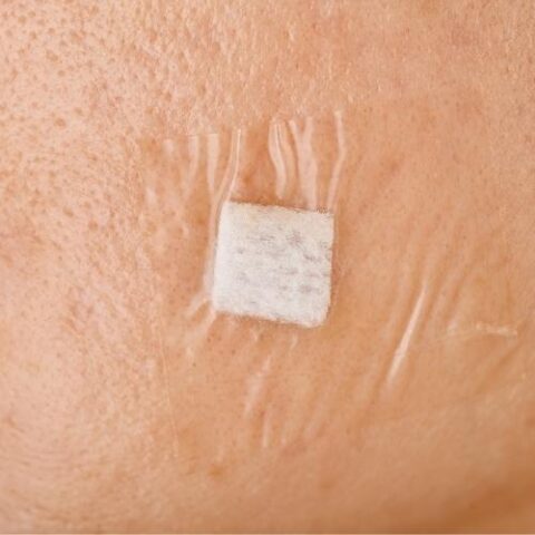 Home nurse preparing dressing materials for Transparent Dressing at home service in South Mumbai.